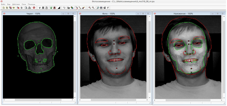 результат фотосовмещения с формальным совпадением некоторых анатомо-морфологических ориентиров
